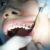 Poradnik dla Rodziców: Jak Dbać o Zęby Dzieci od Młodości